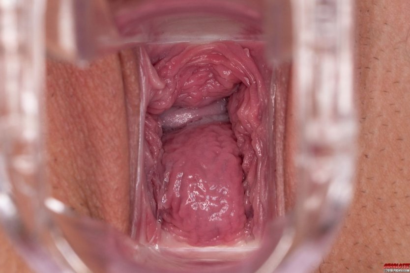 Часть тела xxx inside vagina cervix